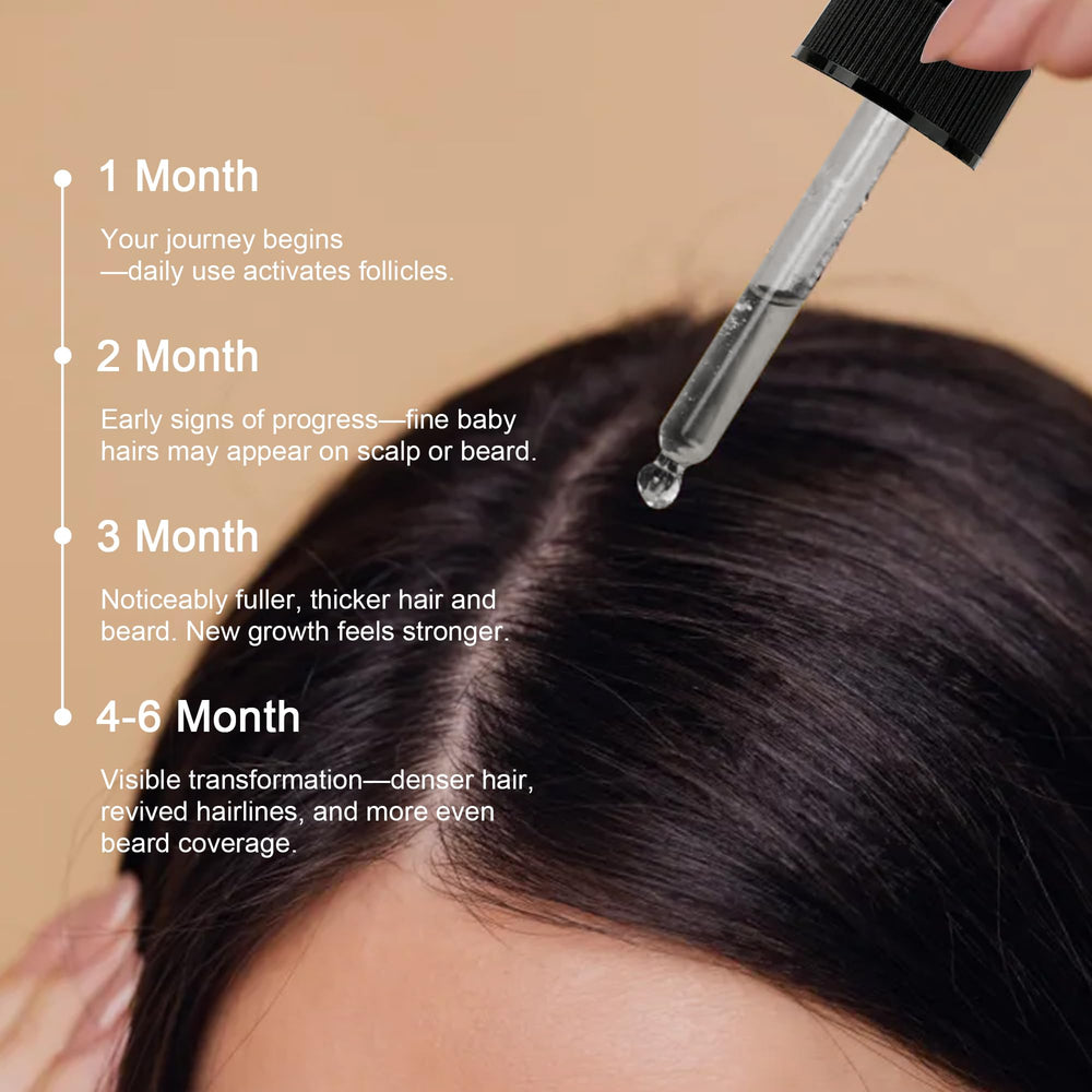 Hosioe Minoxidil fortalece folículos capilares para un cabello sólido.