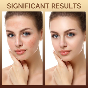 HZENPPOR envase-sin-fragancia: producto sin perfume para piel sensible