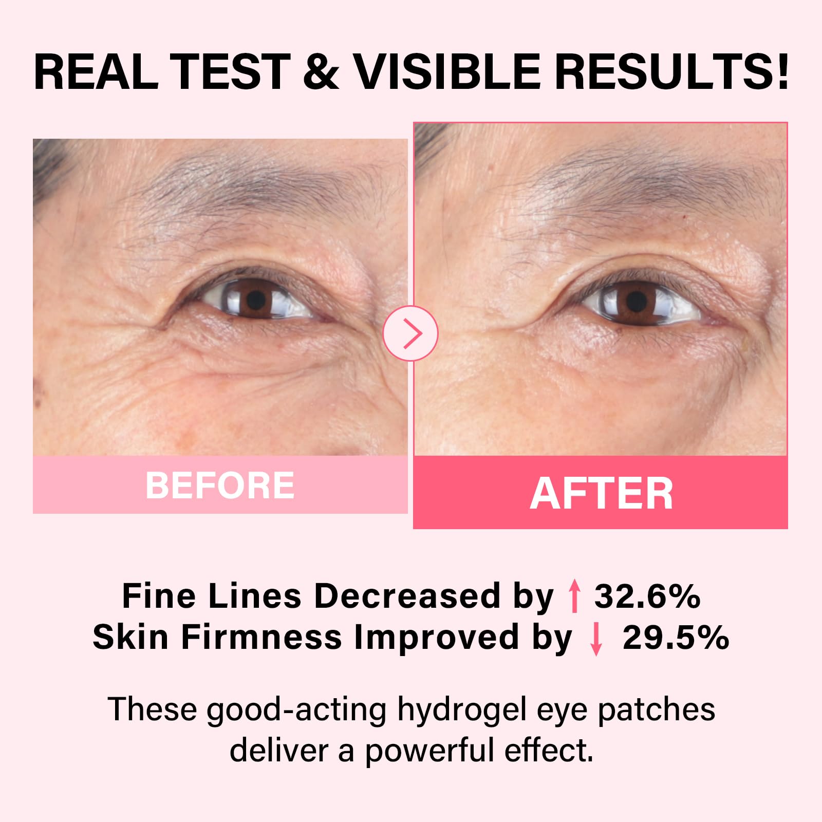 iMethod PDRN Parches Ojos Refrescantes reducen hinchazón y despiertan la mirada
