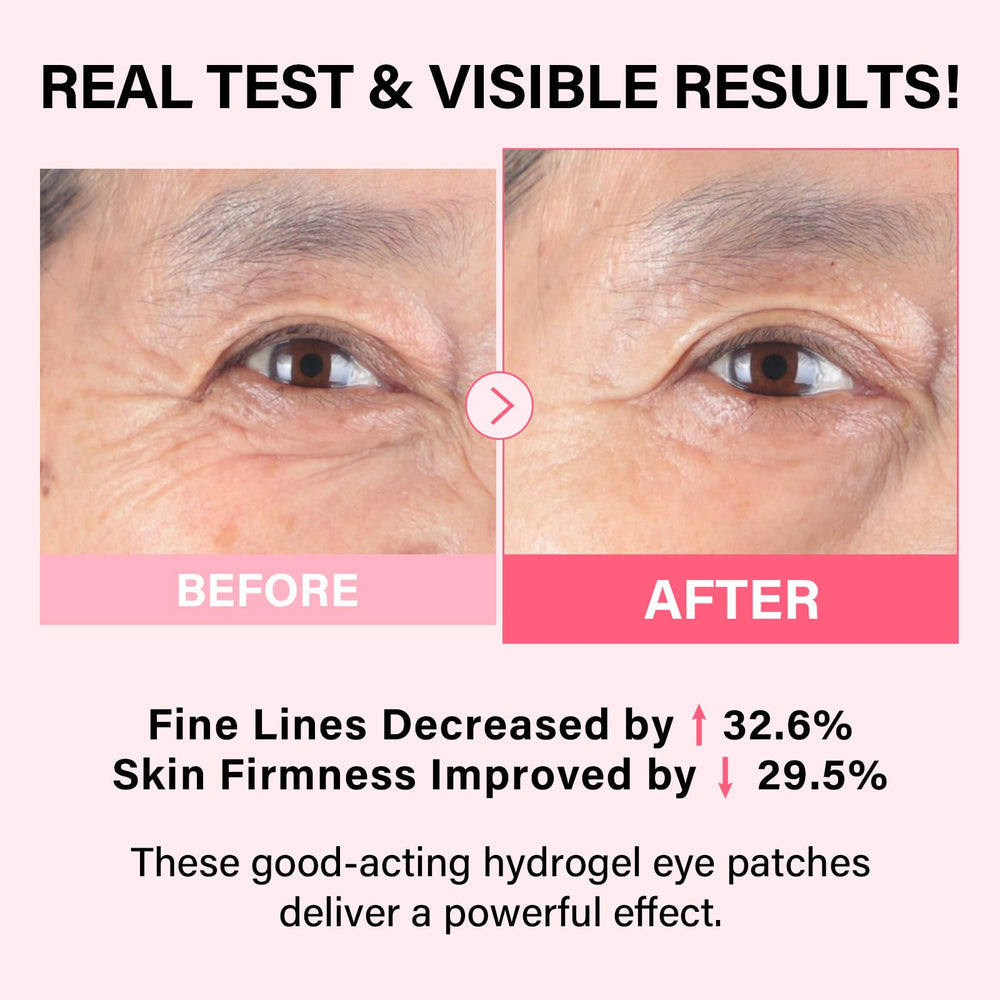 iMethod PDRN Parches Ojos Refrescantes reducen hinchazón y despiertan la mirada