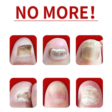 IMOLL pack de dos frascos de 30 ml para uñas con jengibre