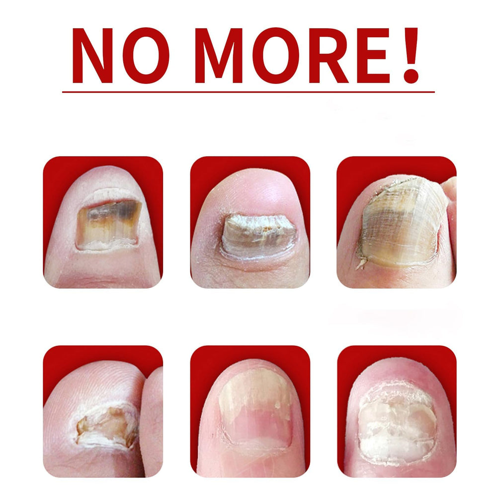 IMOLL pack de dos frascos de 30 ml para uñas con jengibre