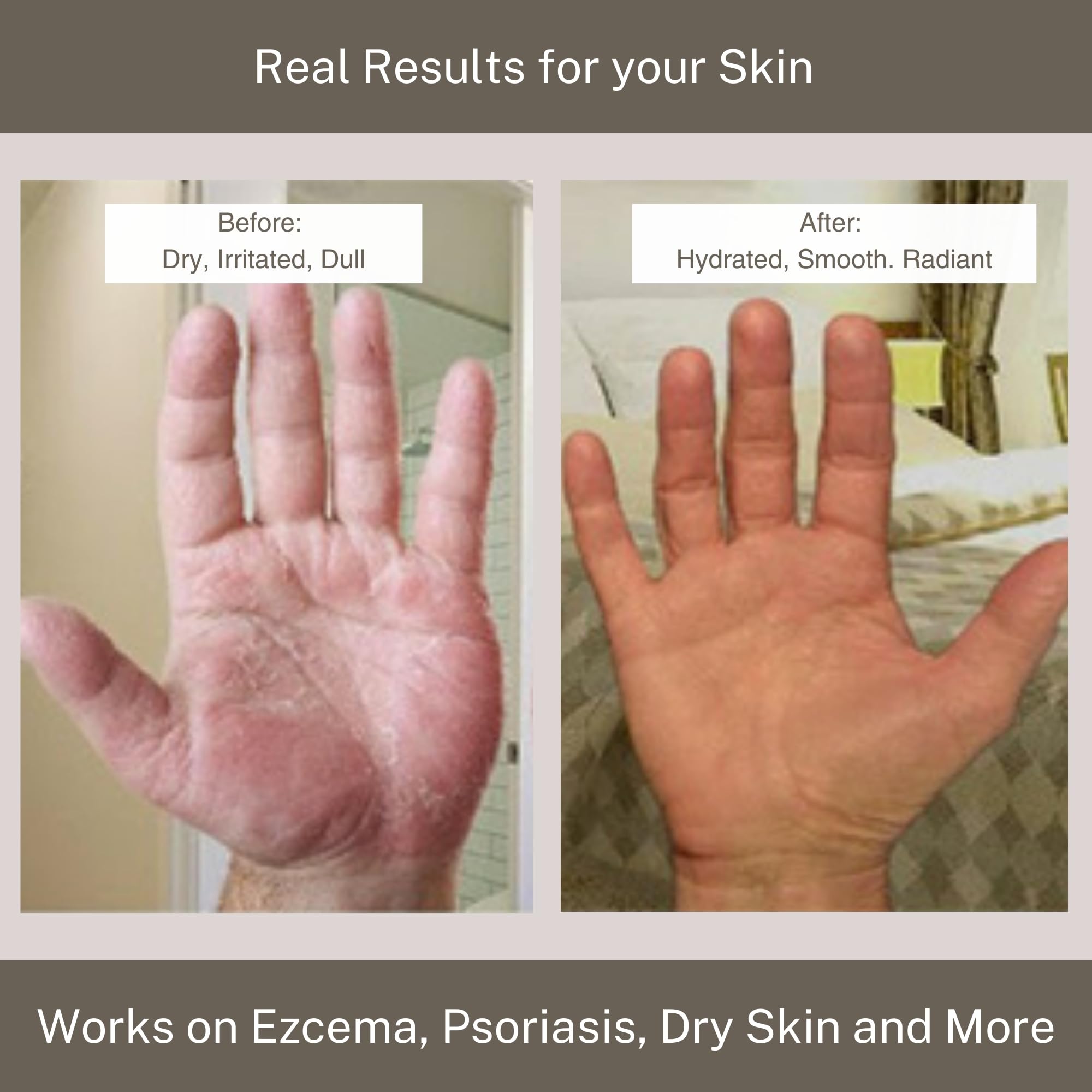 InfiniteAloe: crema de aloe vera con intervenciones naturales para piel suave y radiante.