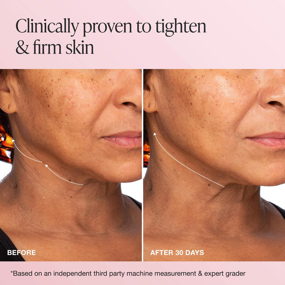 Aplicación de Innbeauty Project Extreme Cream ayuda a definir el contorno facial.