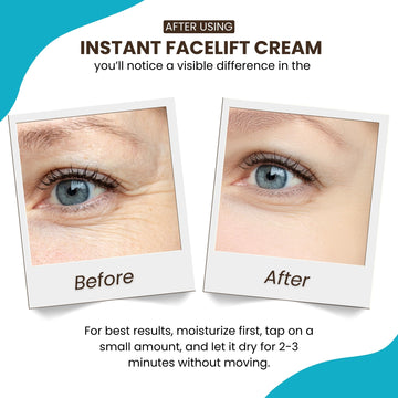 Instantly Ageless: levantamiento facial instantáneo para una apariencia más suave