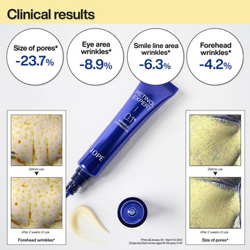 IOPE Retinol Expert contorno boca, cuidado específico del contorno de la boca