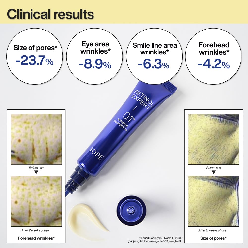 IOPE Retinol Expert contorno boca, cuidado específico del contorno de la boca