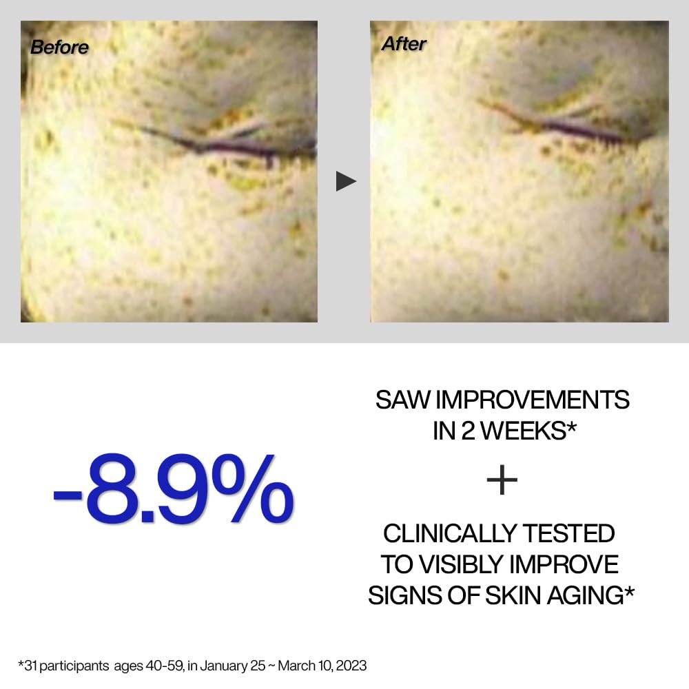 IOPE Retinol Expert ojos-arrugas, ayuda a suavizar líneas finas alrededor de los ojos