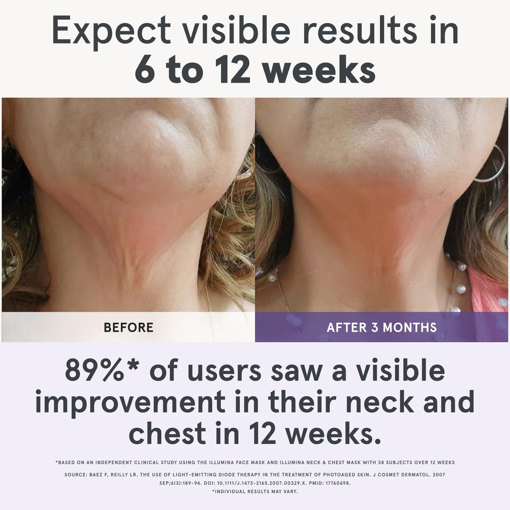 iRestore Illumina: mascarilla cuello con luz infrarroja para firmeza suave.