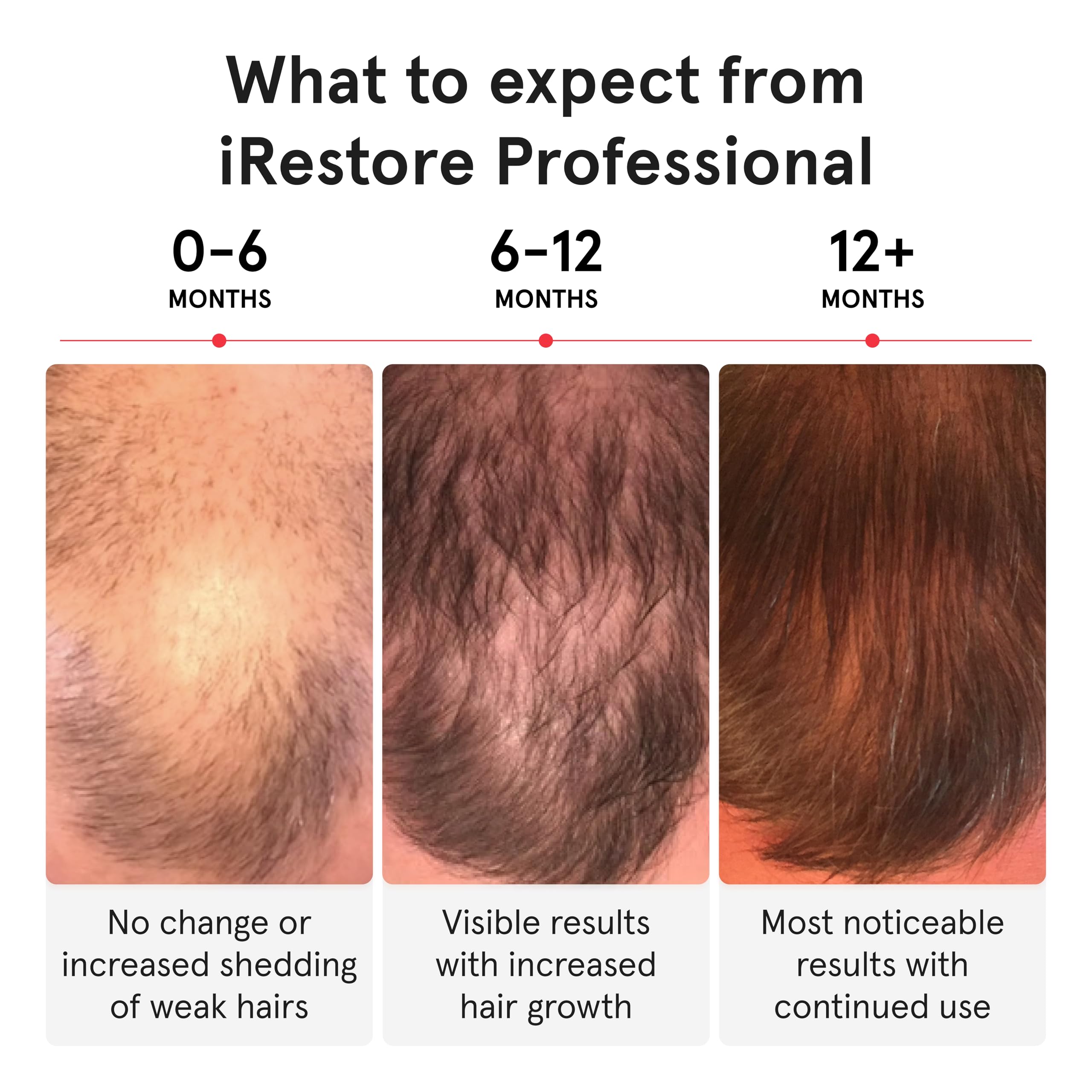iRestore Professional, diseño ventilado y cómodo para uso prolongado