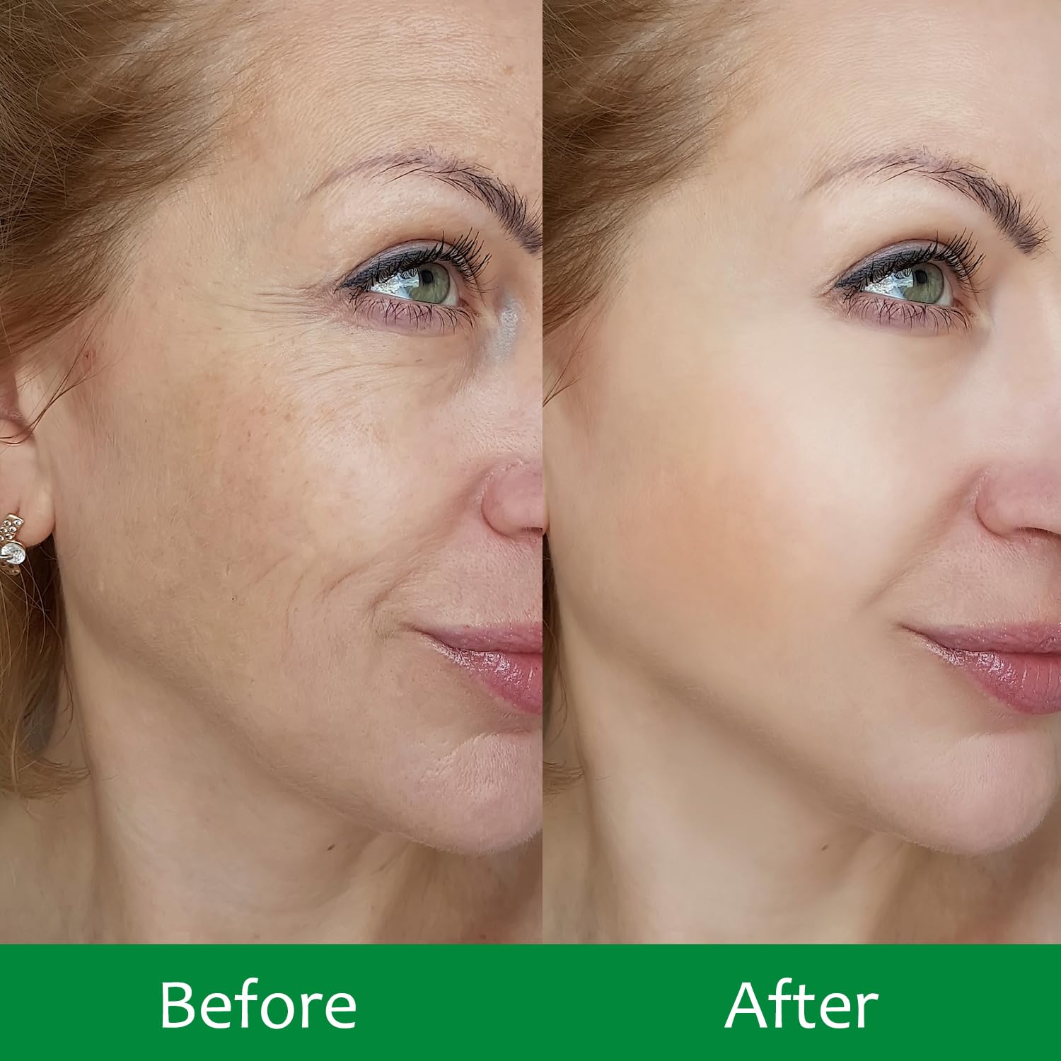 Mascarilla facial IREV antiarrugas para suavizar líneas finas