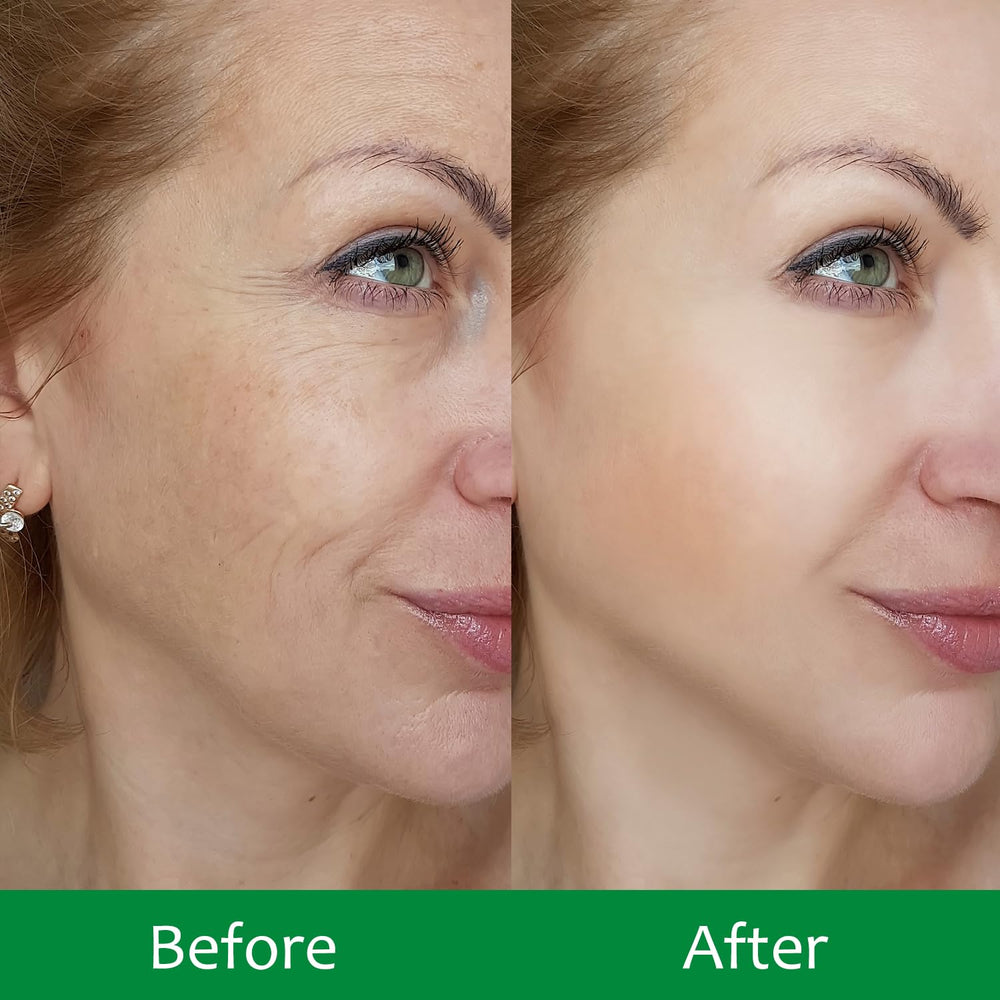 Mascarilla facial IREV antiarrugas para suavizar líneas finas