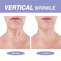 Irismistx crema cuello: textura enriquecida para elevación suave