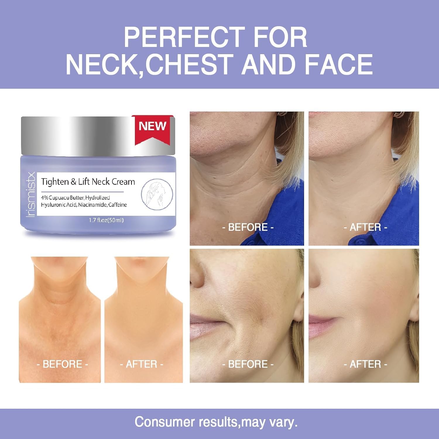 Irismistx crema cuello: aplicación nocturna para cuidado de la piel sensible