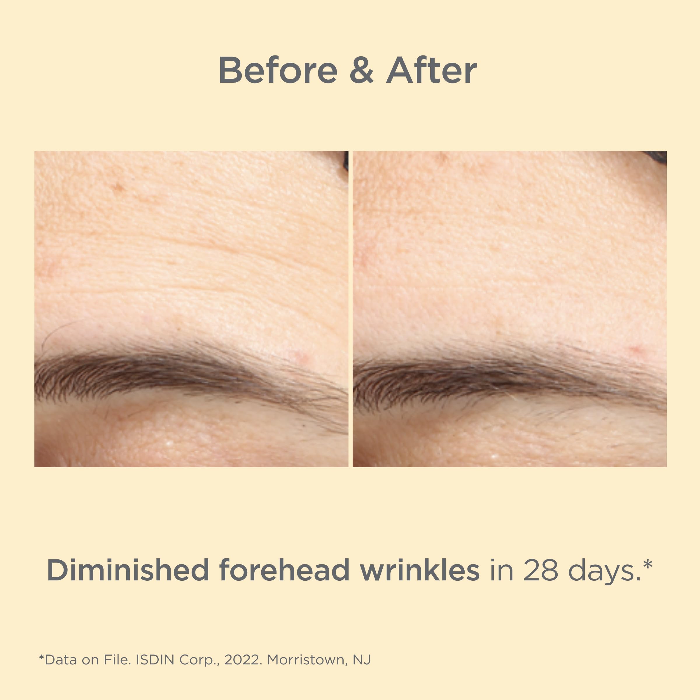 ISDIN Age Contour antioxidantes y niacinamida calman el tono de la piel.