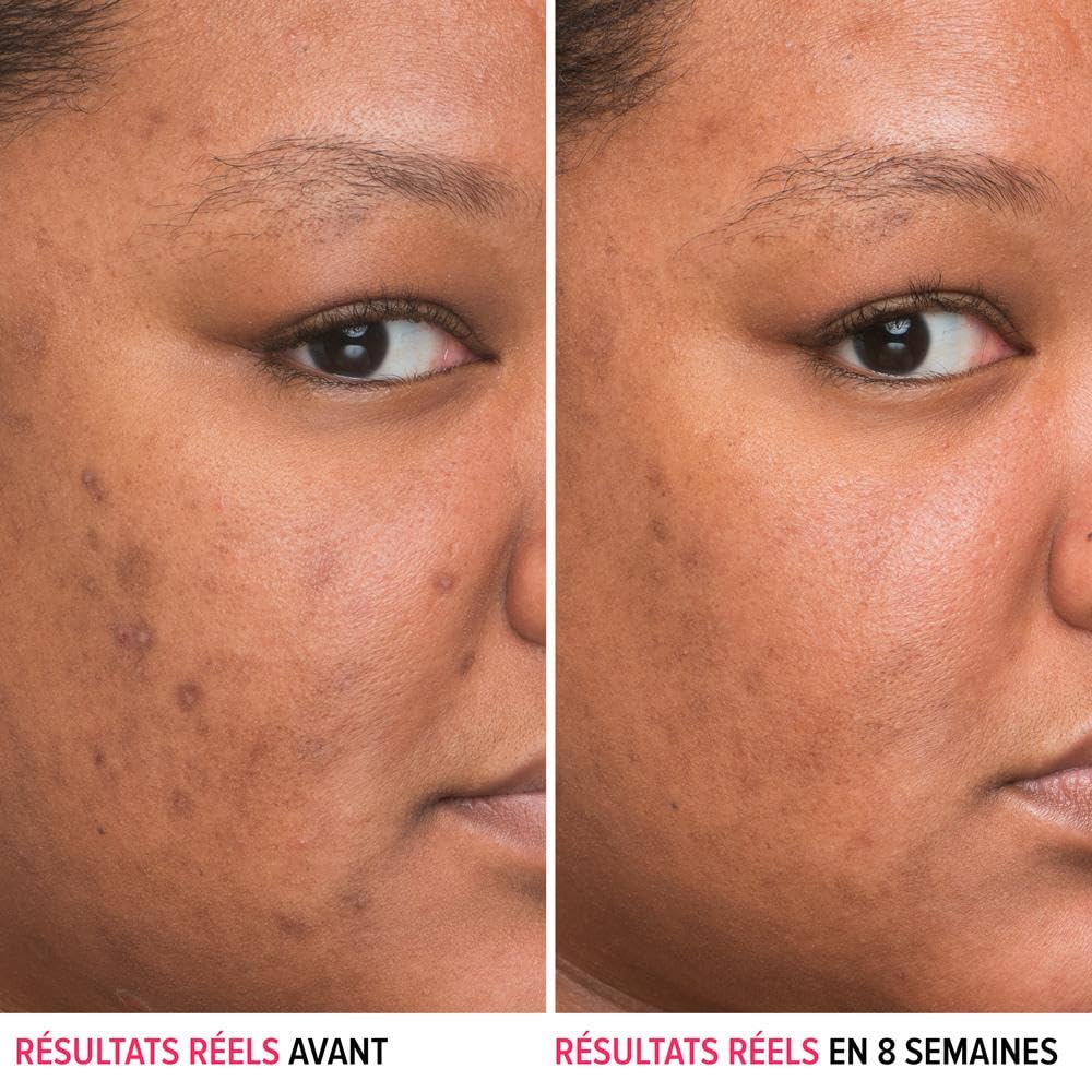 Aplicación diaria en la piel: 4-5 gotas para rostro y cuello.