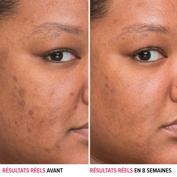 Aplicación diaria en la piel: 4-5 gotas para rostro y cuello.