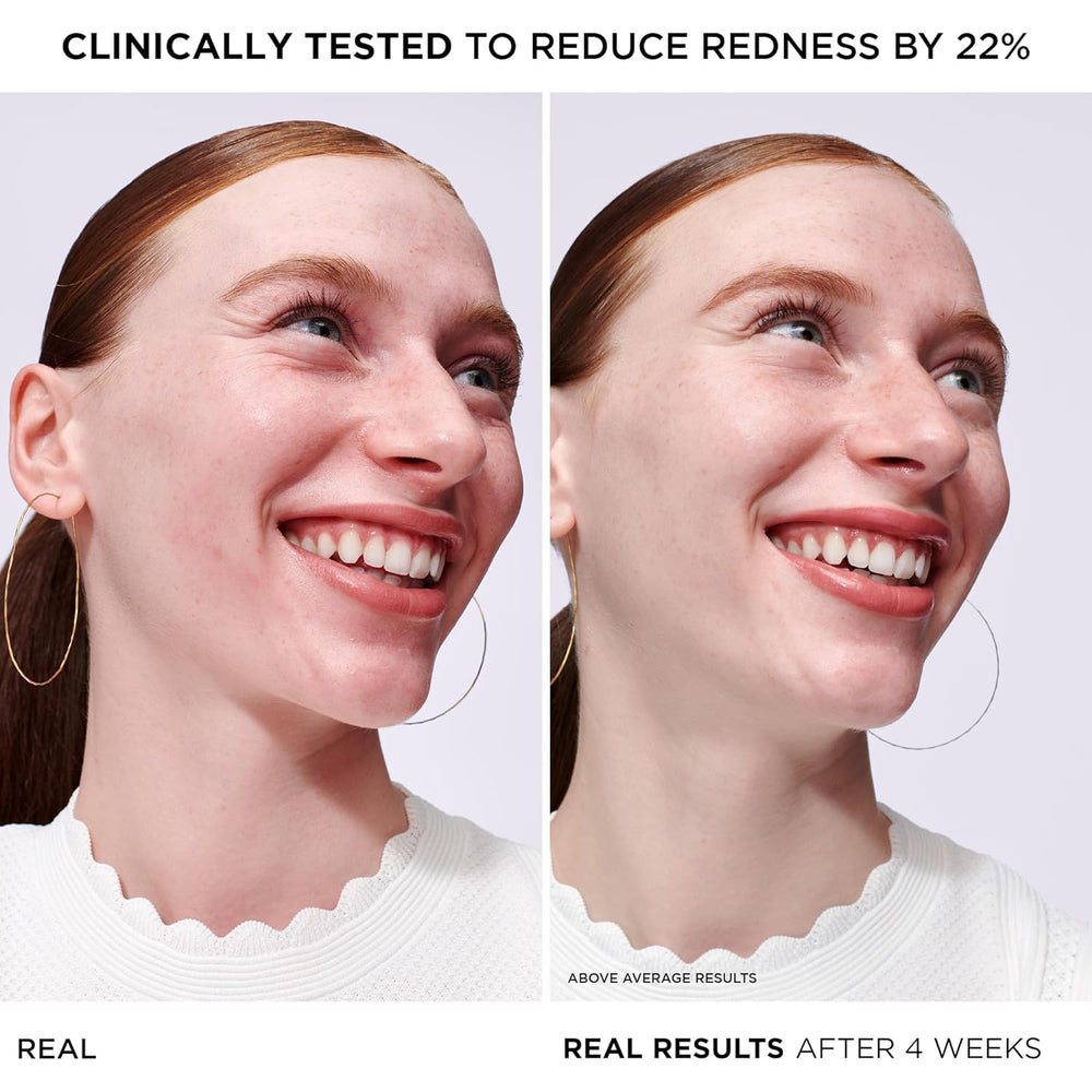 IT Cosmetics Bye Bye Redness Serum, cuidado diario, hidratación de 24 horas para piel sensible