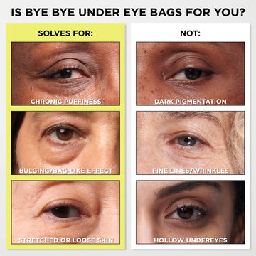 Tecnología de desenfoque que ayuda a reducir visualmente las bolsas alrededor de los ojos.