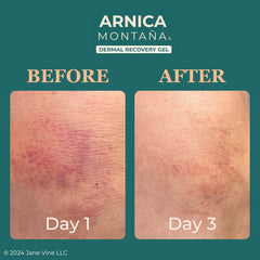 JANE VINE Arnica Gel, textura suave ideal para piel sensible.