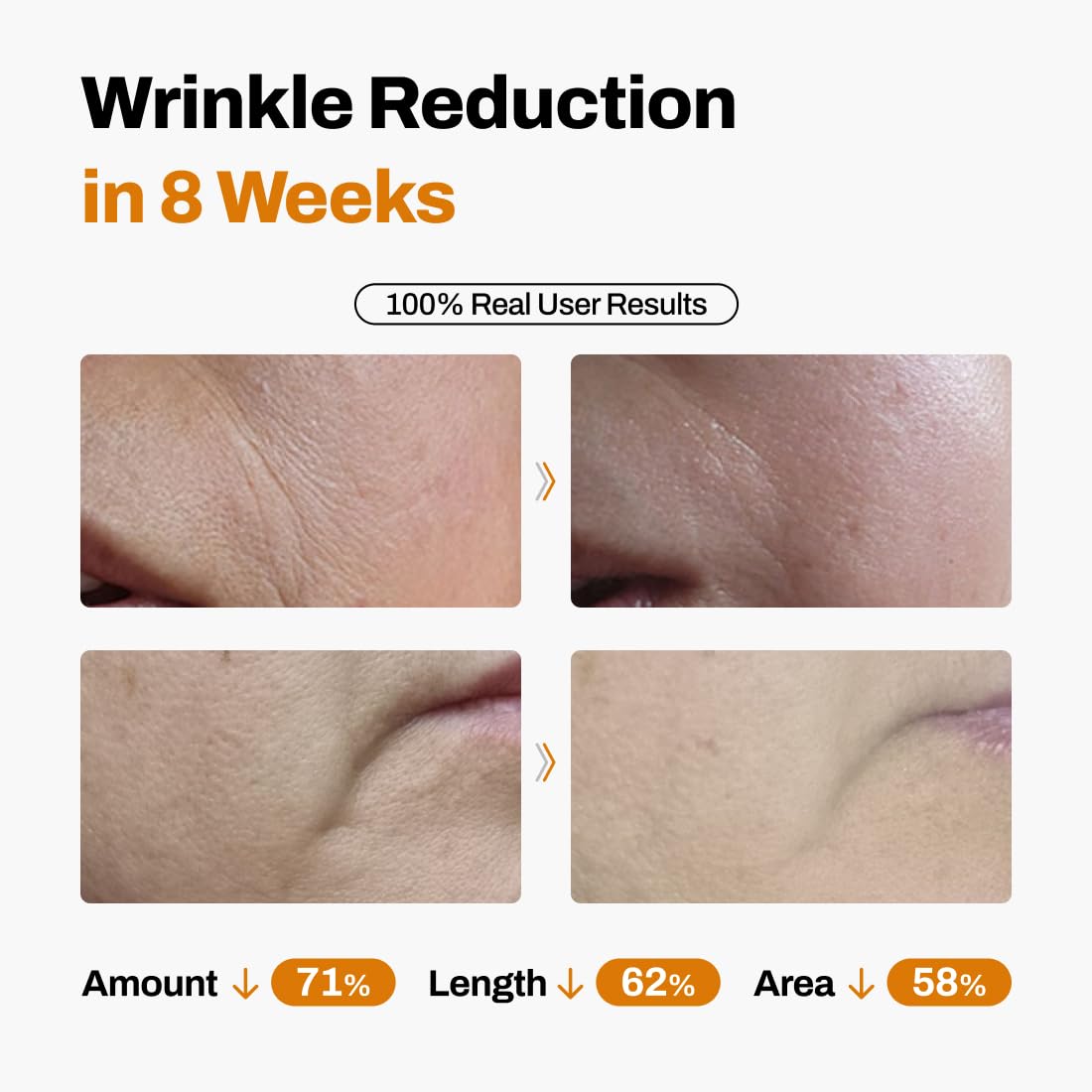 JeuDemeure DermiShuttle: aplicación suave del suero en rostro.