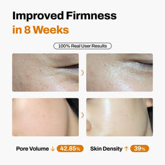 JeuDemeure DermiShuttle: resultados a 8 semanas con lifting visible.