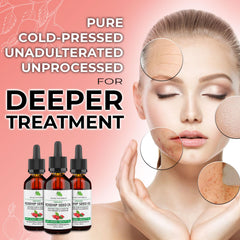 Jeune Naturelle Aceite de Rosa Mosqueta con pulpa y semillas para nutrición facial.