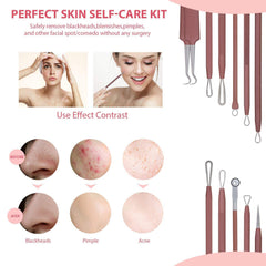 JPNK herramientas para imperfecciones, variedad para control