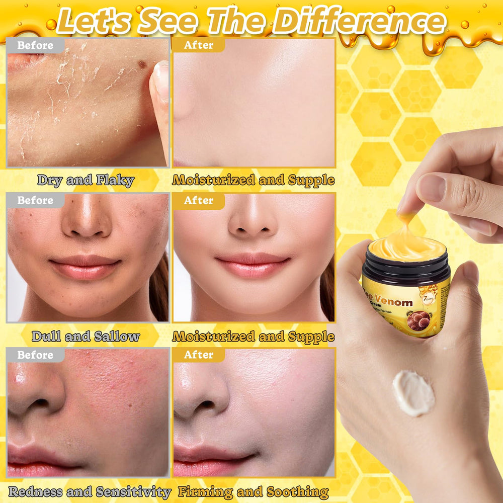 Aplicación cuello con JUANCHI veneno de abeja para suavidad.
