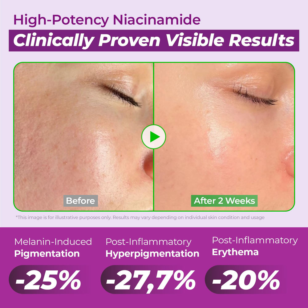 JUMISO Niacinamide 20% sérum réduit l'apparence des pores et la texture peau.