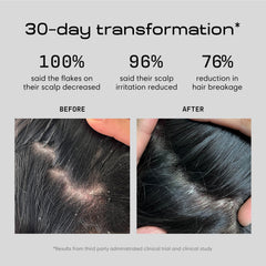 Sérum de Jupiter con aloe: calma y nutre el cuero cabelludo.