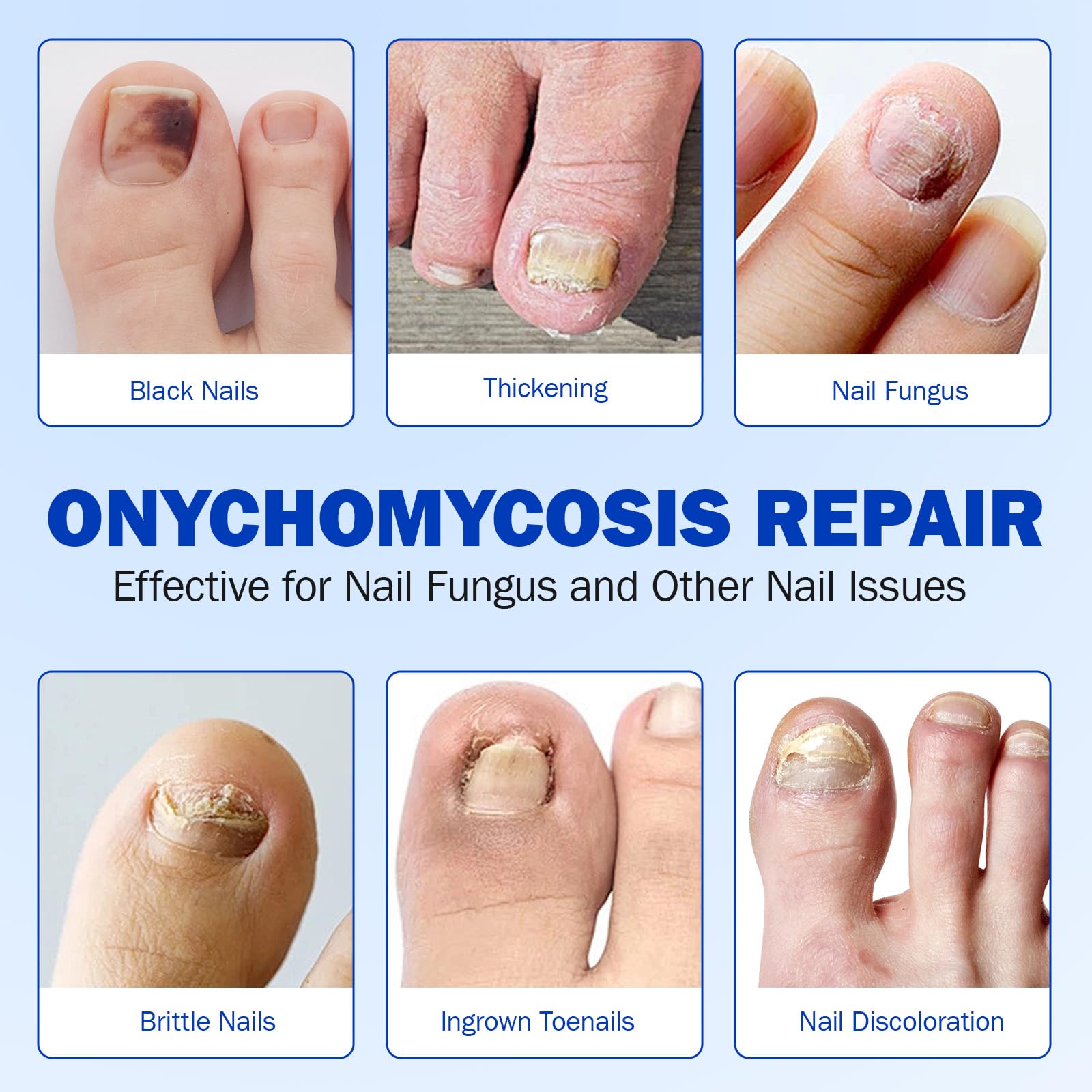 JWBVCTCR patch on toe nail demonstrates discreet, comfortable wear