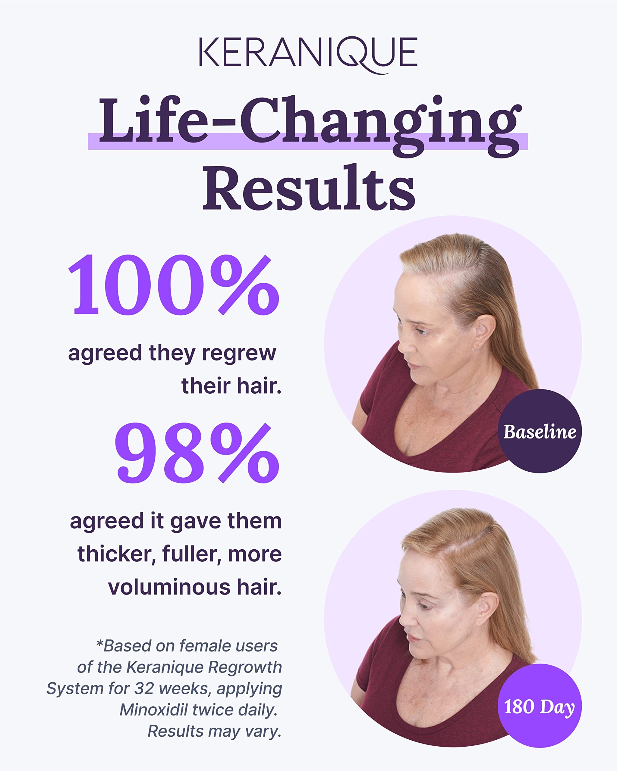 Keranique: minoxidil 2 pourcent pour la croissance capillaire féminine.