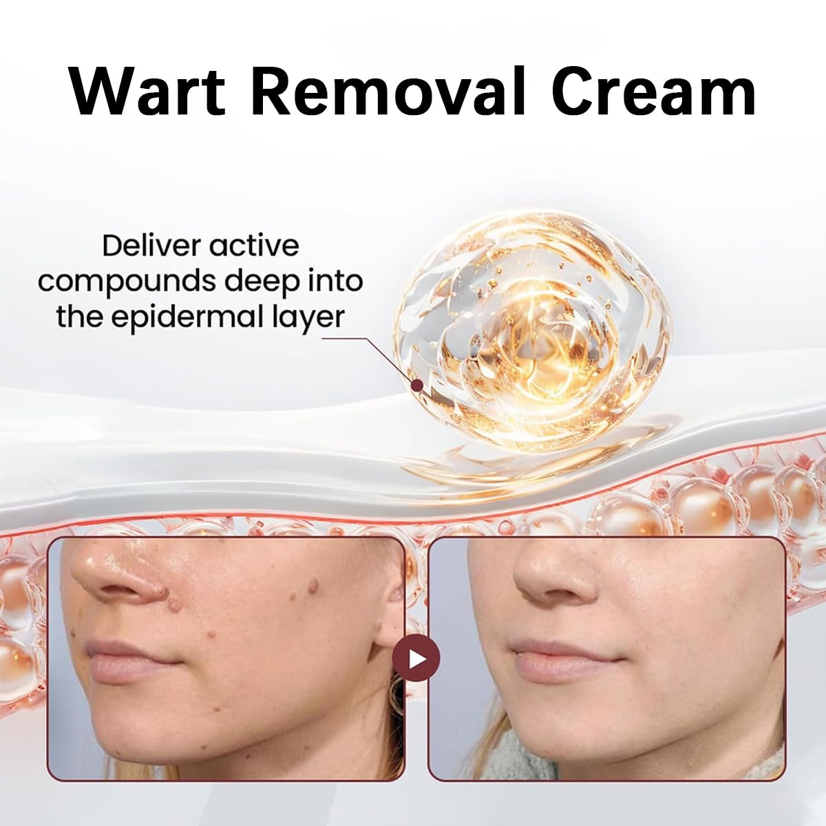 KeraErase crema: textura cremosa para nutrición suave de la piel.