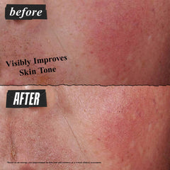 Kiehl's Ultra Facial Advanced Repair Barrier Cream, beta-glucano como ingrediente clave para reparación.