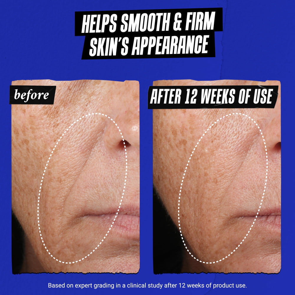 Manos aplicando Kiehl's Midnight Recovery Concentrate con masaje suave en rostro.