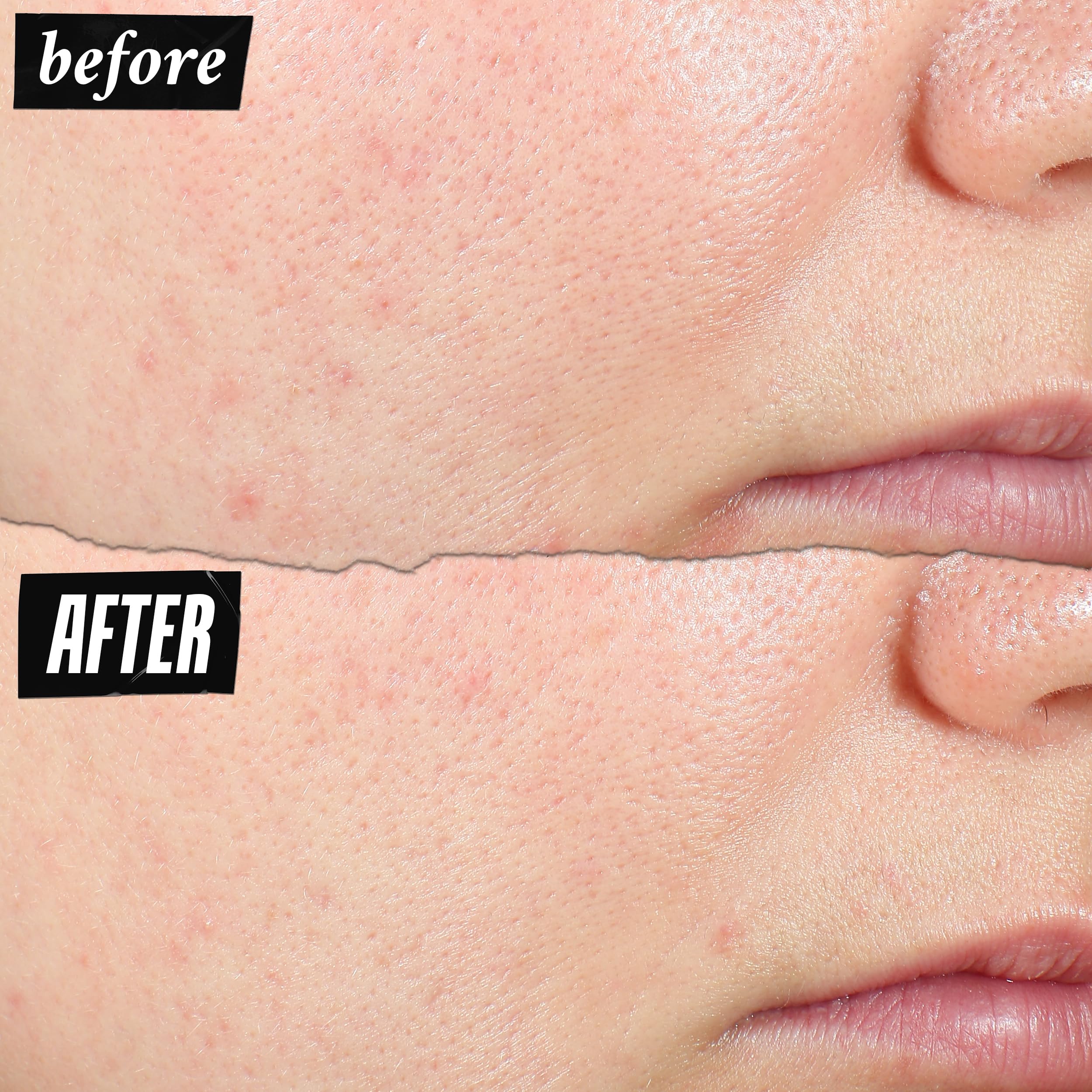 Kiehl's Expertly Clear aplicación diaria hidrata sin resecar la piel