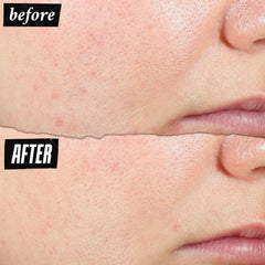 Kiehl's Expertly Clear aplicación diaria hidrata sin resecar la piel