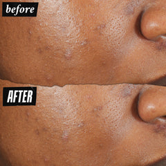 Kiehl’s Niacinamida 4% para iluminar y unificar tono de piel.