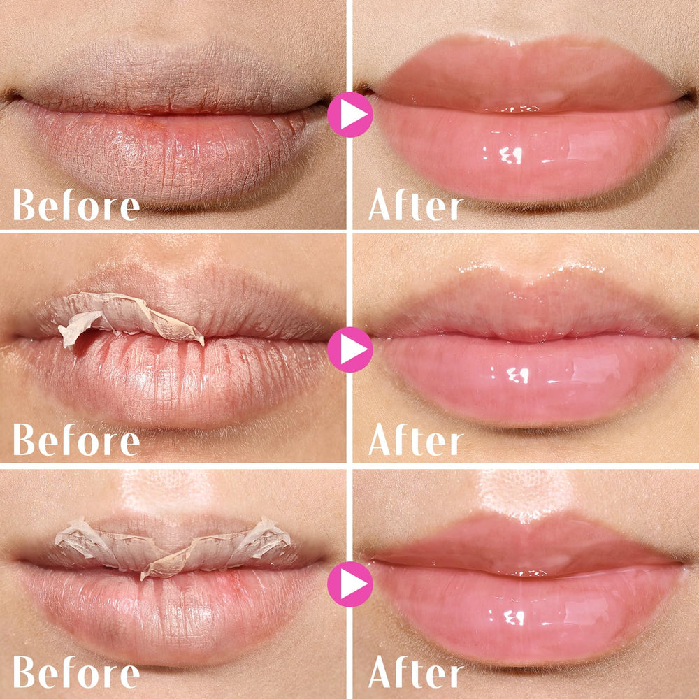 KIMUSE máscara labial con vitamina C para nutrir y revitalizar los labios.