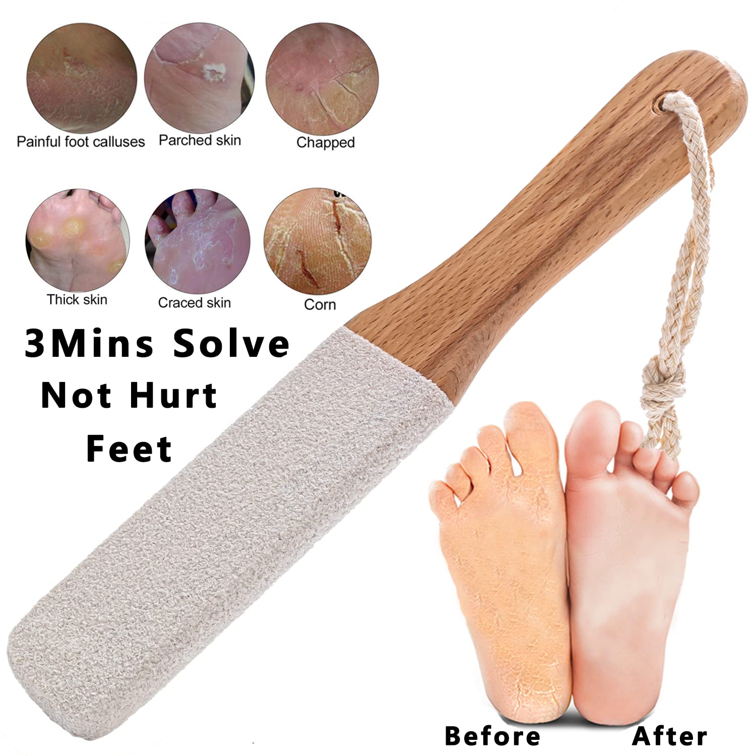 Kinepi kit de pedicura para uso casero con resultado profesional.