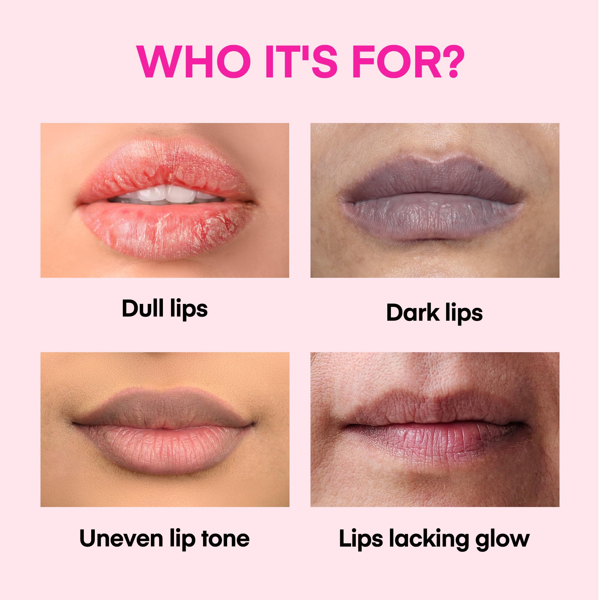 KissBea Lip Lightening: vitamina C y regaliz para tono más uniforme.