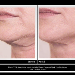 Kleem Organics aplicación suave en cuello y rostro para hidratación.