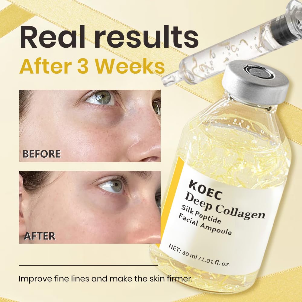 KOEC levantamiento contorno facial mejora elasticidad de la piel.