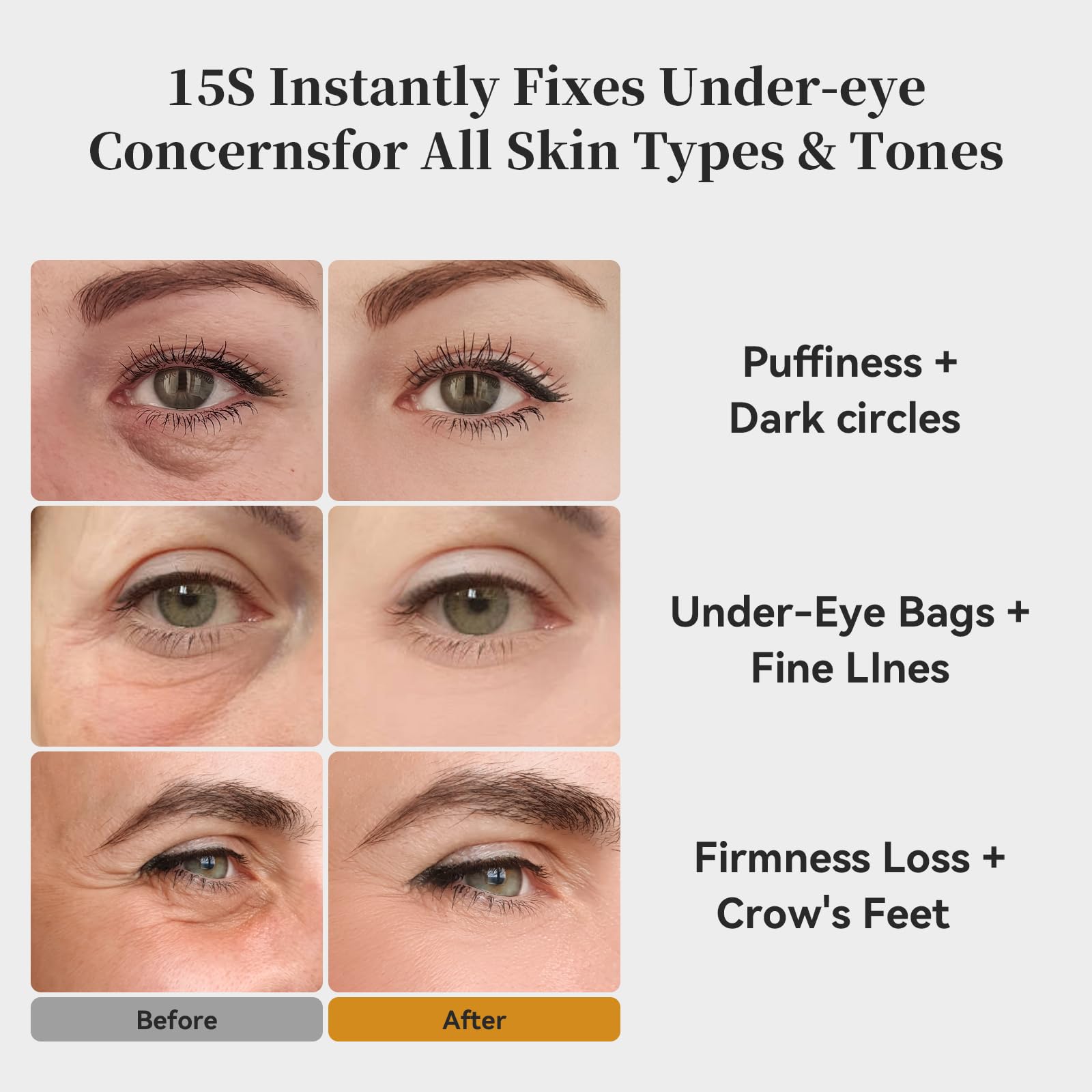 KOKN 15S Eye Cream under-eye area close-up for smoother skin.
