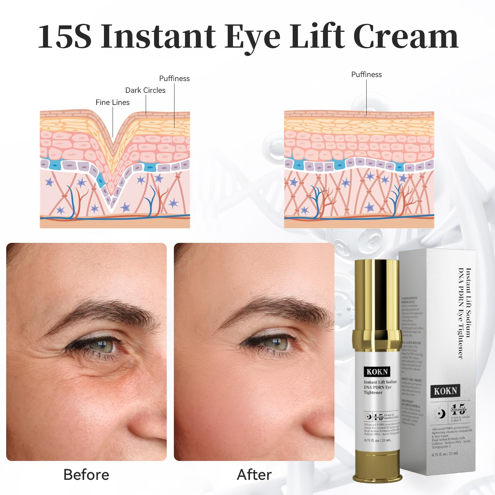 KOKN 15S Eye Cream wrinkle-smoothing close-up highlights fainter lines.