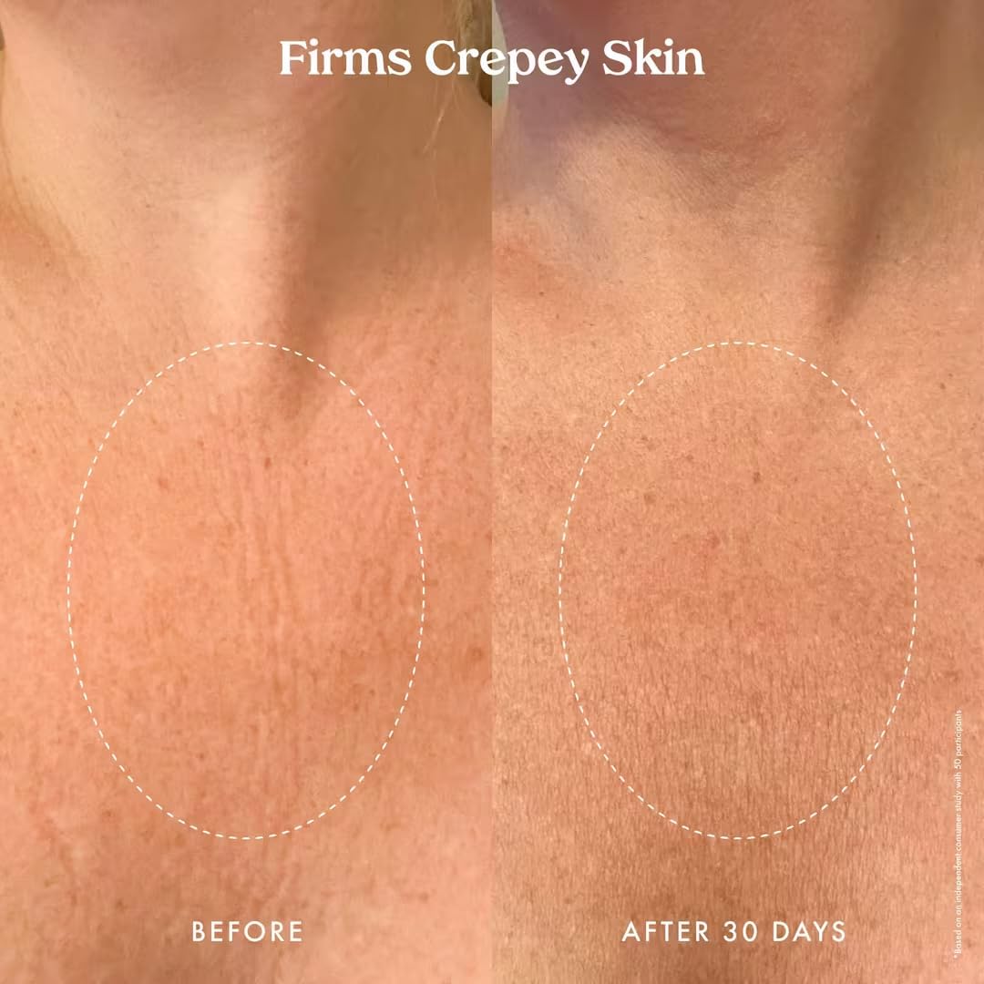 Aplicación en brazo con crema corporal de absorción rápida.