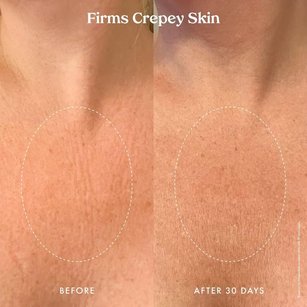 Aplicación en brazo con crema corporal de absorción rápida.