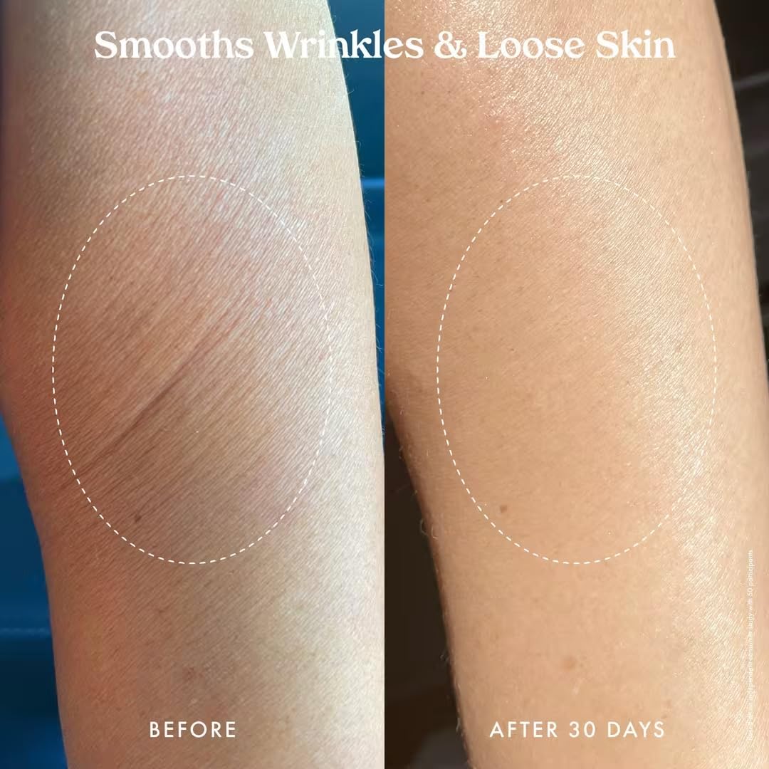 Piel más suave en zonas crepé con crema corporal.