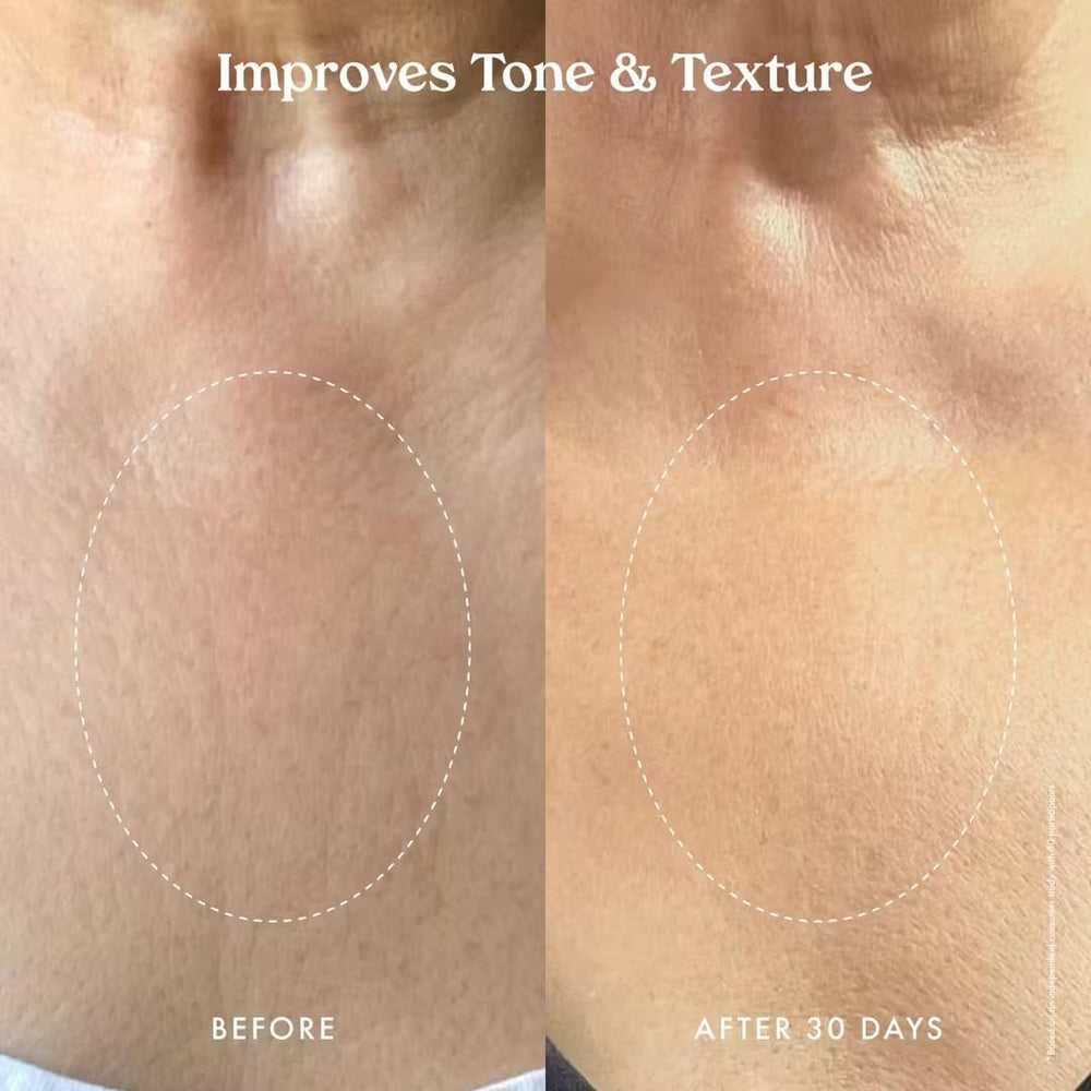 Kopari Ultra Restore Serum, doble péptido que mejora tono y elasticidad.